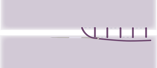 ladder stitch